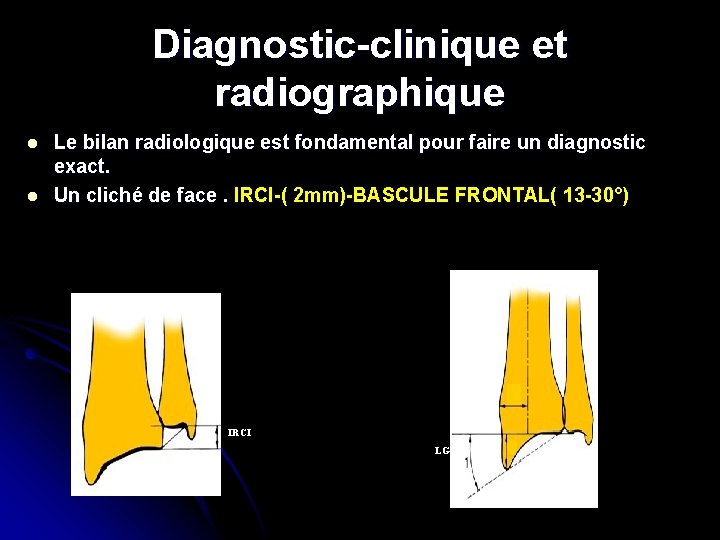 Diagnostic-clinique et radiographique l l Le bilan radiologique est fondamental pour faire un diagnostic