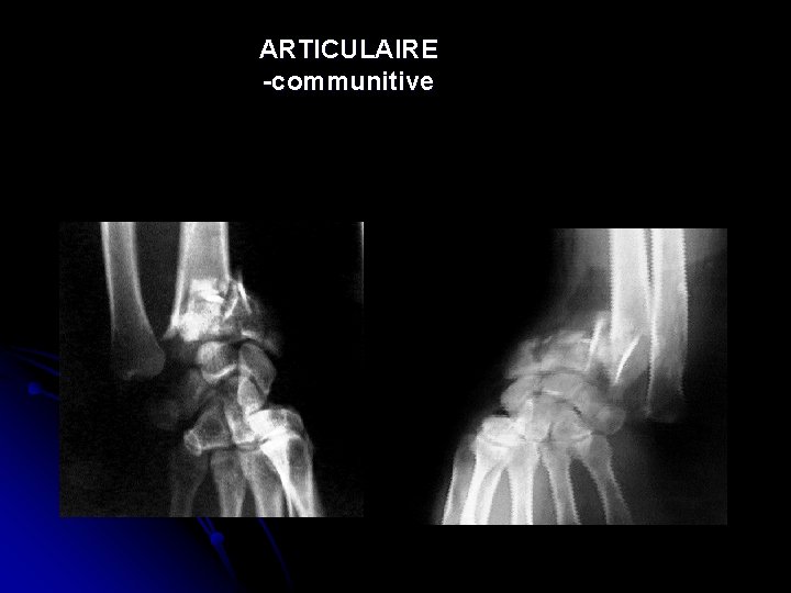 ARTICULAIRE -communitive 