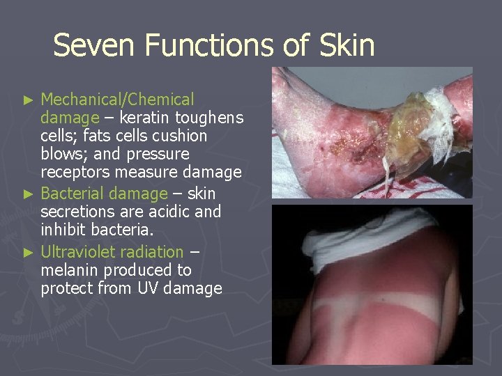 Seven Functions of Skin Mechanical/Chemical damage – keratin toughens cells; fats cells cushion blows; Seven Functions of Skin Mechanical/Chemical damage – keratin toughens cells; fats cells cushion blows;