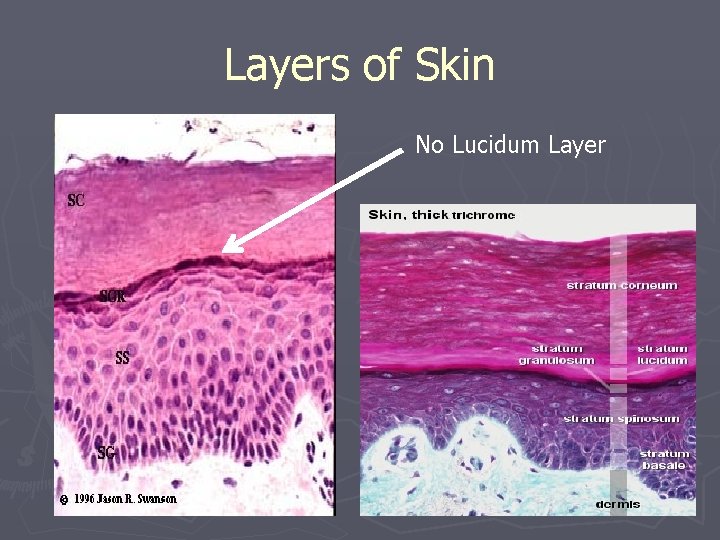 Layers of Skin No Lucidum Layer Layers of Skin No Lucidum Layer