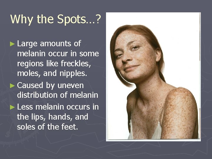 Why the Spots…? ► Large amounts of melanin occur in some regions like freckles, Why the Spots…? ► Large amounts of melanin occur in some regions like freckles,