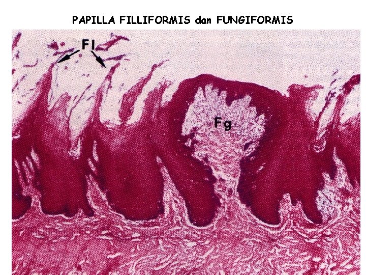 PAPILLA FILLIFORMIS dan FUNGIFORMIS 17 