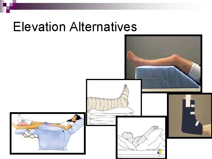 Elevation Alternatives 