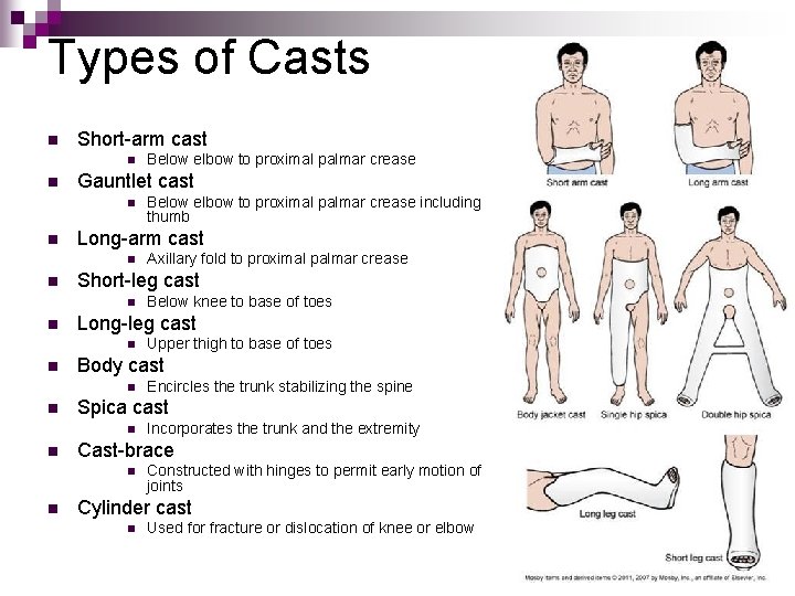 Types of Casts n Short-arm cast n n Gauntlet cast n n Incorporates the