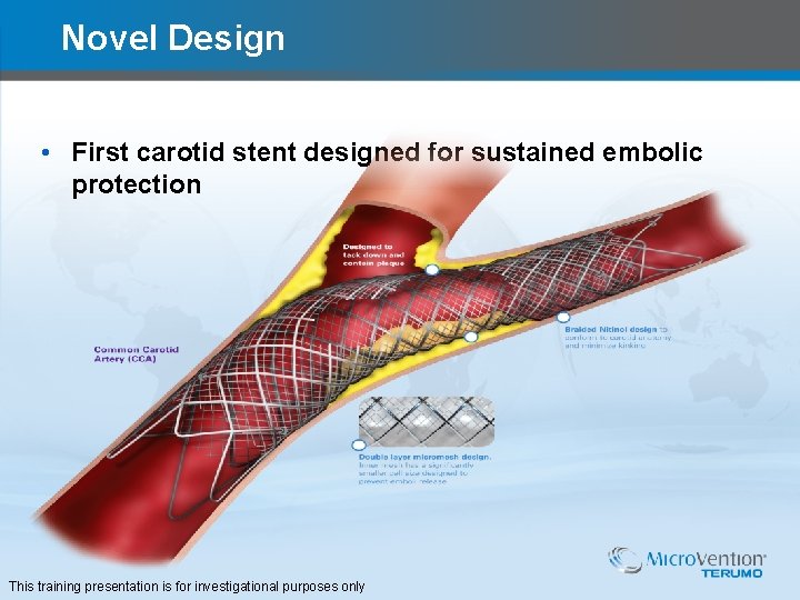 Novel Design • First carotid stent designed for sustained embolic protection This training presentation