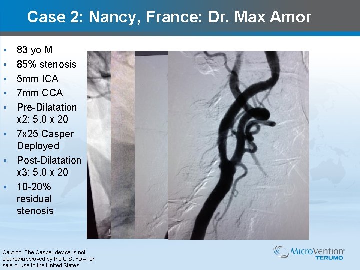 Case 2: Nancy, France: Dr. Max Amor • • • 83 yo M 85%