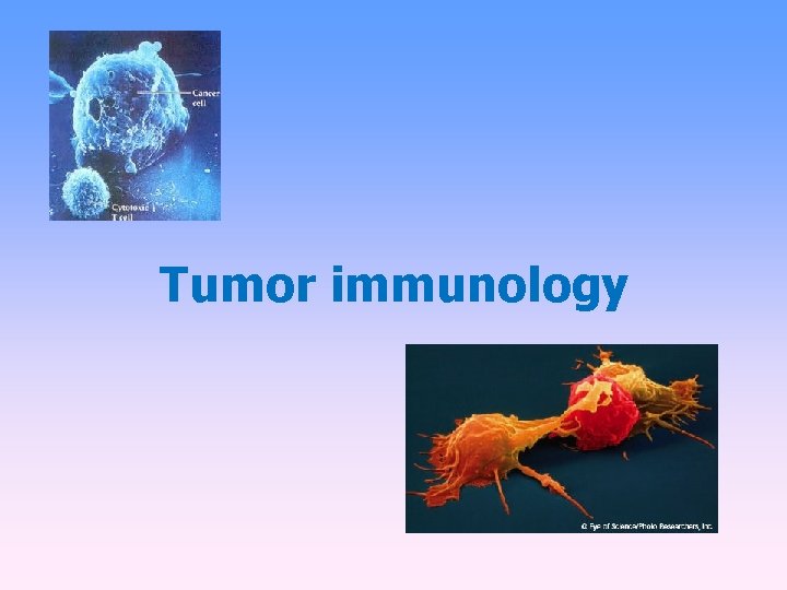 Tumor immunology 