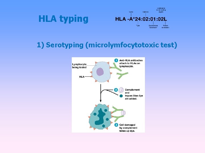 HLA typing 1) Serotyping (microlymfocytotoxic test) 