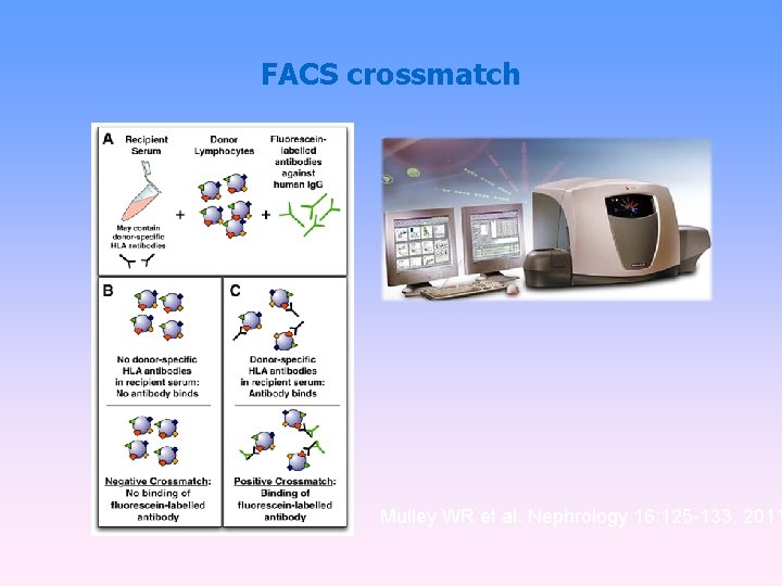 FACS crossmatch Mulley WR et al. Nephrology 16: 125 -133, 2011 