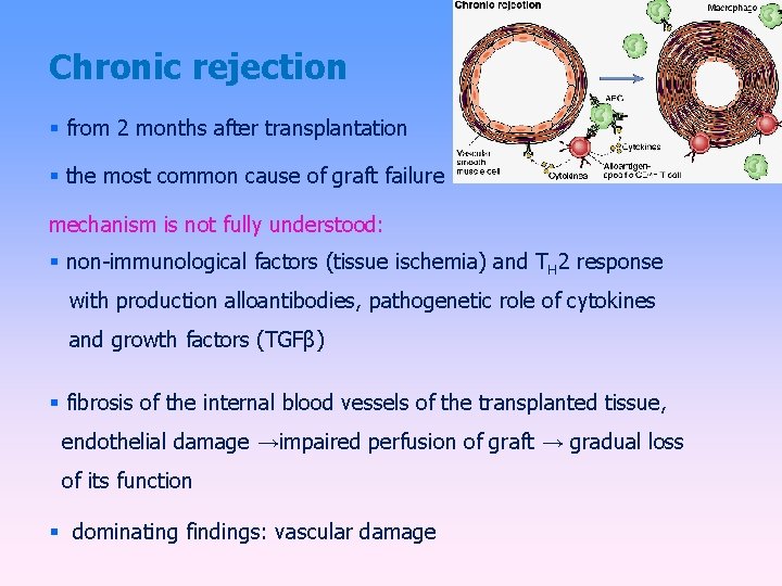 Chronic rejection from 2 months after transplantation the most common cause of graft failure