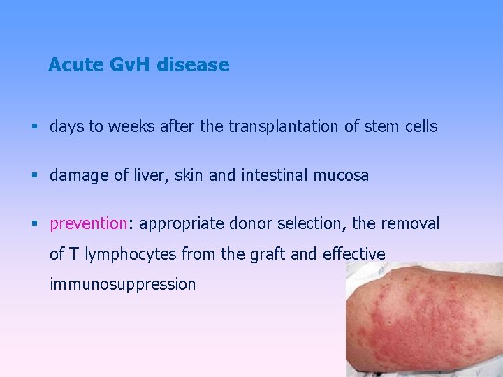 Acute Gv. H disease days to weeks after the transplantation of stem cells damage