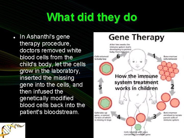 What did they do In Ashanthi's gene therapy procedure, doctors removed white blood cells