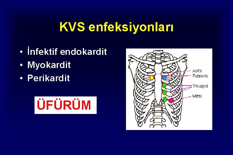 KVS enfeksiyonları • İnfektif endokardit • Myokardit • Perikardit ÜFÜRÜM 