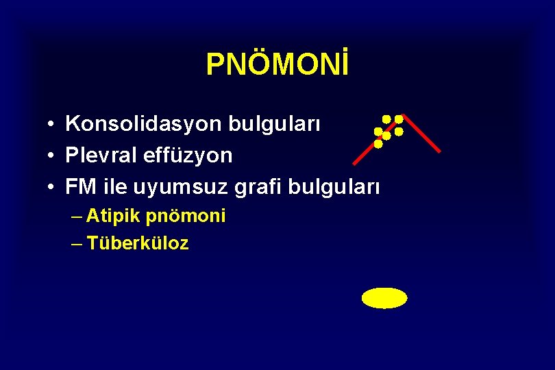 PNÖMONİ • Konsolidasyon bulguları • Plevral effüzyon • FM ile uyumsuz grafi bulguları –