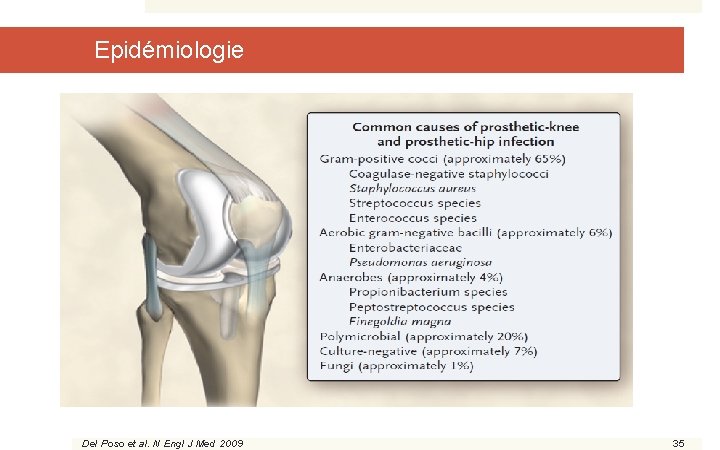 Epidémiologie Del Poso et al. N Engl J Med 2009 35 