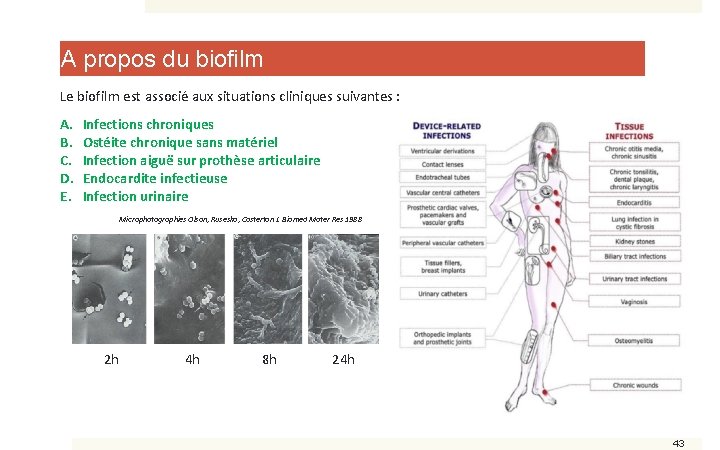 A propos du biofilm Le biofilm est associé aux situations cliniques suivantes : A.