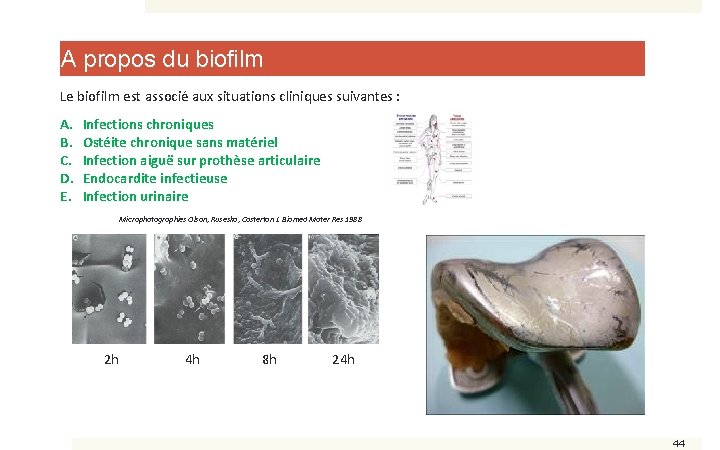 A propos du biofilm Le biofilm est associé aux situations cliniques suivantes : A.