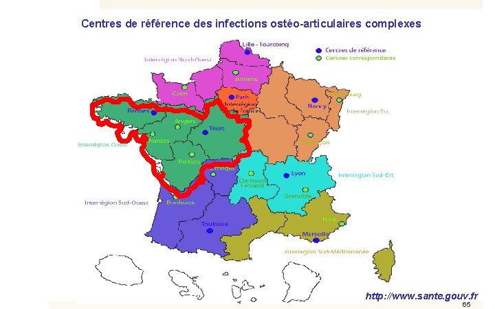 Centres de référence des infections ostéo-articulaires complexes http: //www. sante. gouv. fr 65 