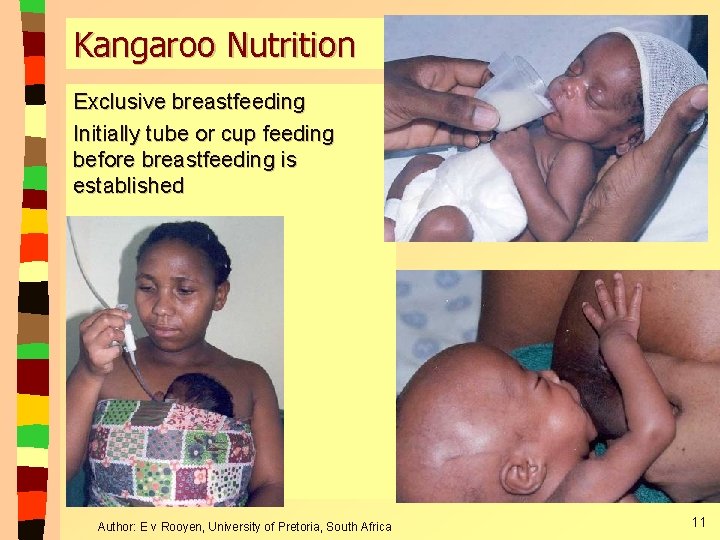 Kangaroo Nutrition Exclusive breastfeeding Initially tube or cup feeding before breastfeeding is established Author: Kangaroo Nutrition Exclusive breastfeeding Initially tube or cup feeding before breastfeeding is established Author:
