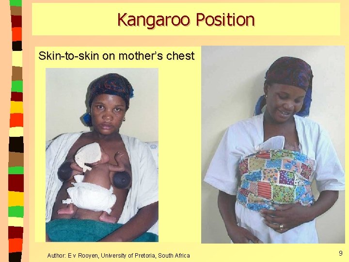 Kangaroo Position Skin-to-skin on mother’s chest Author: E v Rooyen, University of Pretoria, South Kangaroo Position Skin-to-skin on mother’s chest Author: E v Rooyen, University of Pretoria, South