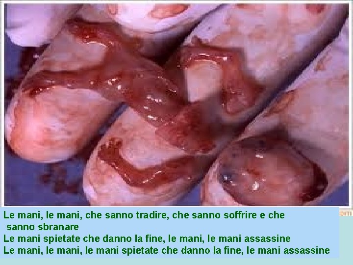 Le mani, le mani, che sanno tradire, che sanno soffrire e che sanno sbranare