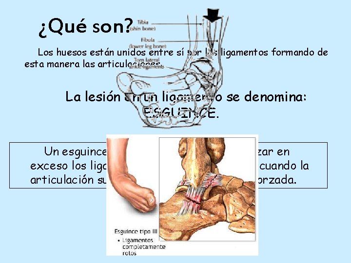 ¿Qué son? Los huesos están unidos entre sí por los ligamentos formando de esta