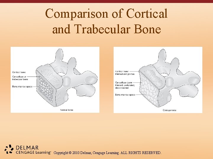 Comparison of Cortical and Trabecular Bone Copyright © 2010 Delmar, Cengage Learning. ALL RIGHTS