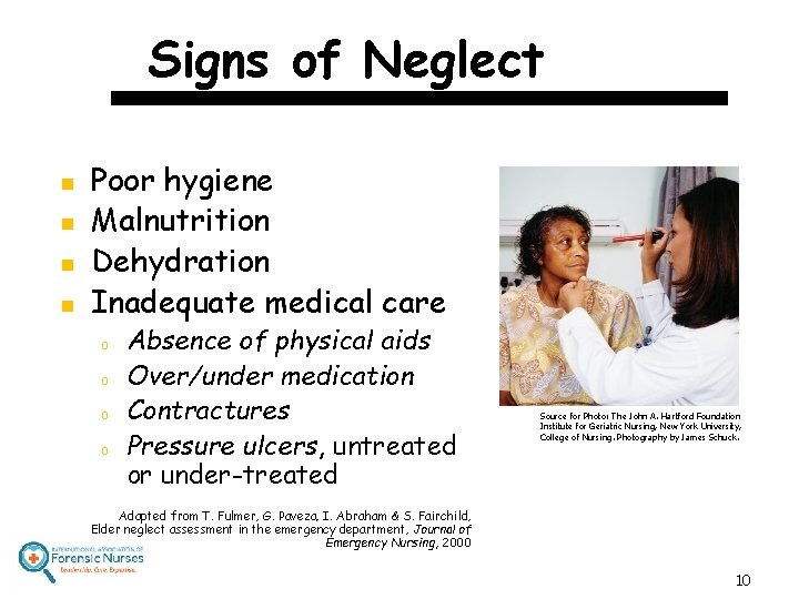 Signs of Neglect n n Poor hygiene Malnutrition Dehydration Inadequate medical care o o