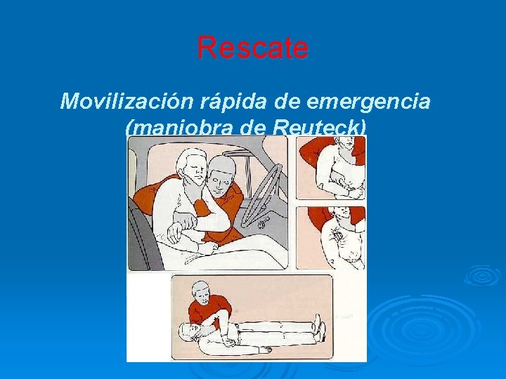 Rescate Movilización rápida de emergencia (maniobra de Reuteck) 