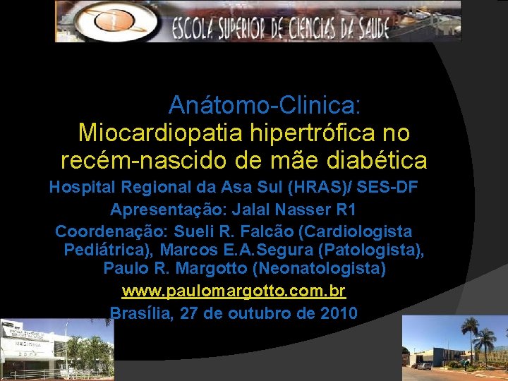  Anátomo-Clinica: Miocardiopatia hipertrófica no recém-nascido de mãe diabética Hospital Regional da Asa Sul