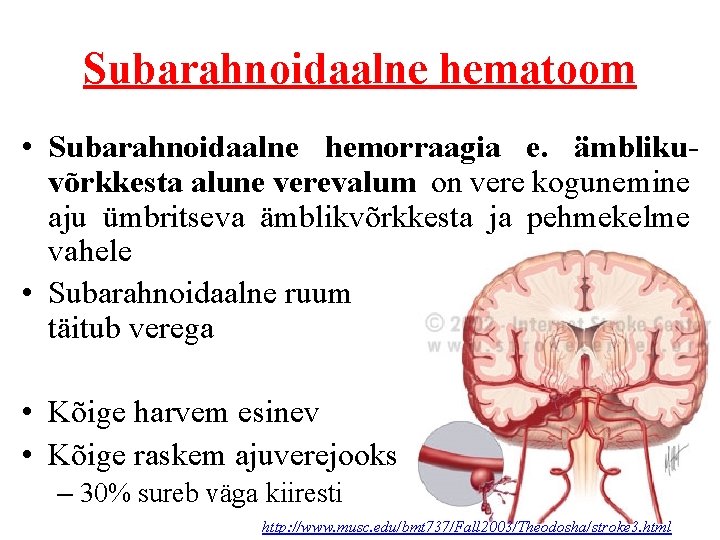 Subarahnoidaalne hematoom • Subarahnoidaalne hemorraagia e. ämblikuvõrkkesta alune verevalum on vere kogunemine aju ümbritseva