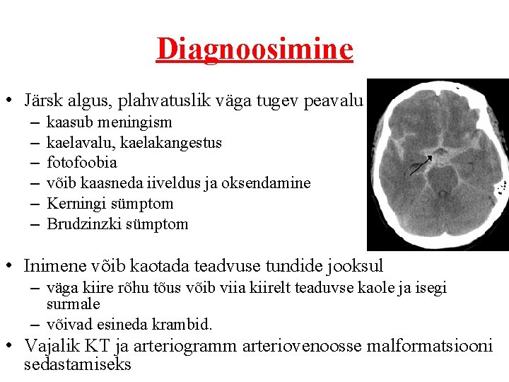 Diagnoosimine • Järsk algus, plahvatuslik väga tugev peavalu – – – kaasub meningism kaelavalu,