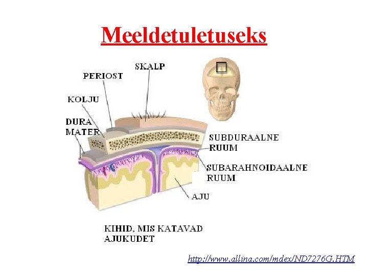 Meeldetuletuseks http: //www. allina. com/mdex/ND 7276 G. HTM 