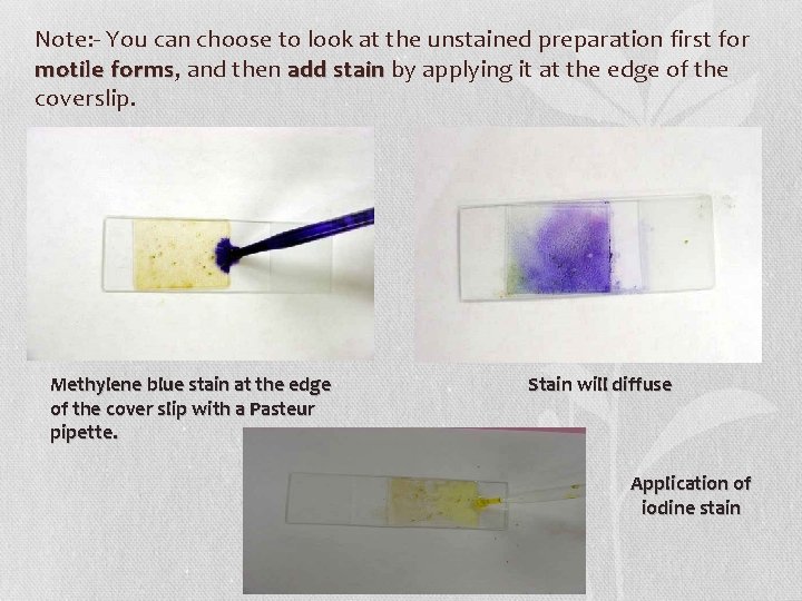Note: - You can choose to look at the unstained preparation first for motile