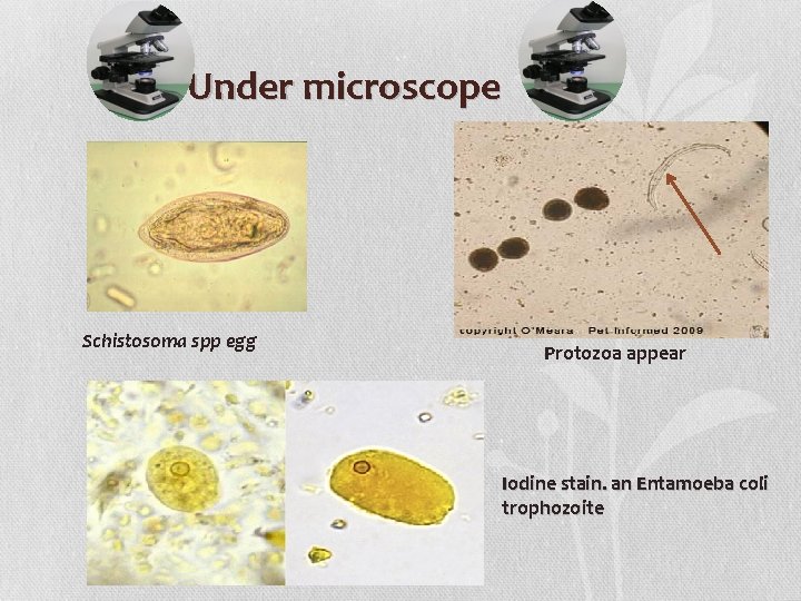 Under microscope Schistosoma spp egg Protozoa appear Iodine stain. an Entamoeba coli trophozoite 