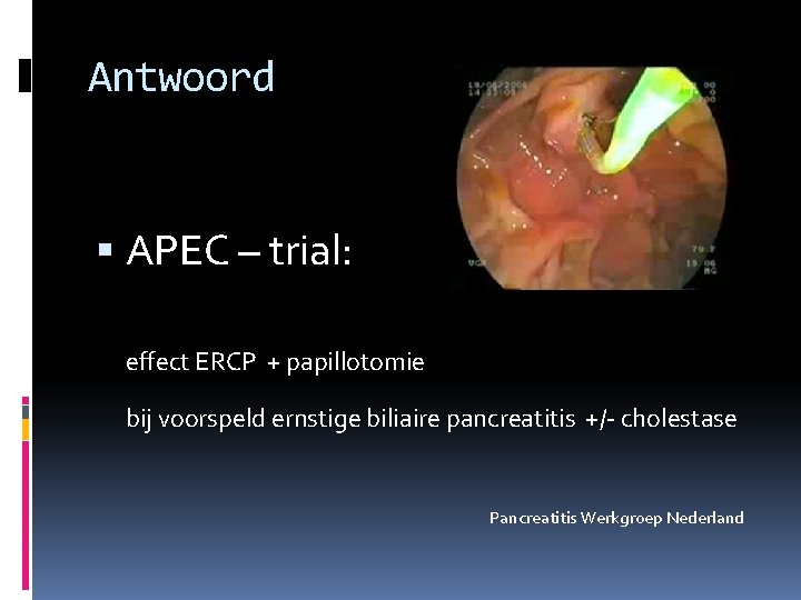 Antwoord APEC – trial: effect ERCP + papillotomie bij voorspeld ernstige biliaire pancreatitis +/-