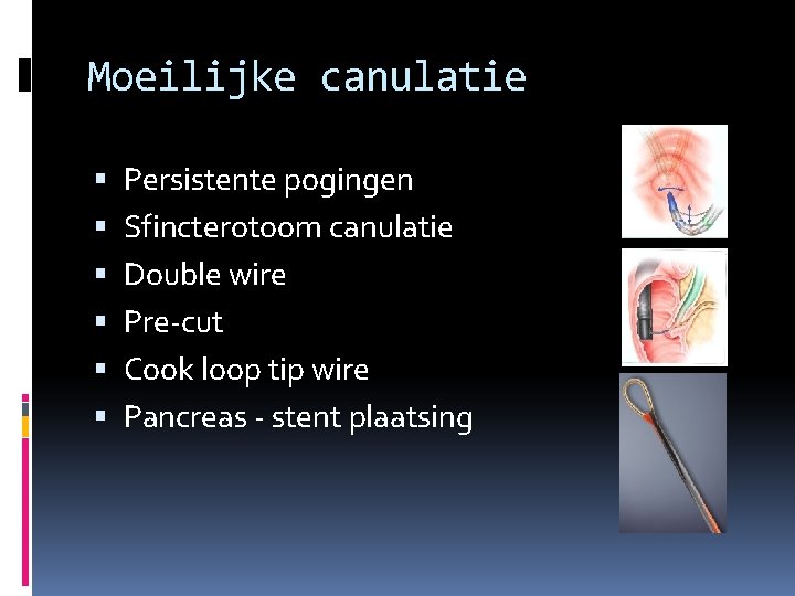 Moeilijke canulatie Persistente pogingen Sfincterotoom canulatie Double wire Pre-cut Cook loop tip wire Pancreas