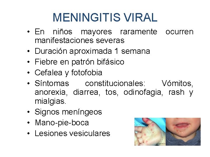 MENINGITIS VIRAL • En niños mayores raramente ocurren manifestaciones severas • Duración aproximada 1