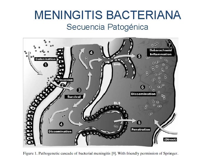 MENINGITIS BACTERIANA Secuencia Patogénica 