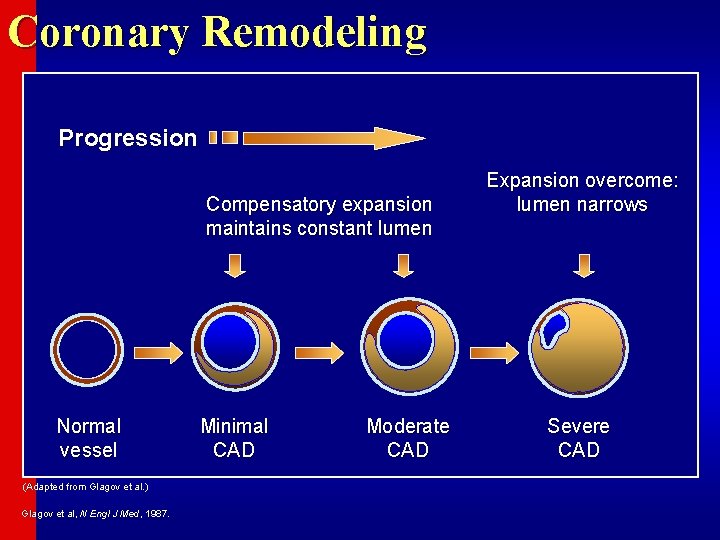 Coronary Remodeling Progression Compensatory expansion maintains constant lumen Normal vessel (Adapted from Glagov et
