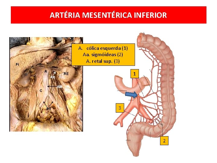 ARTÉRIA MESENTÉRICA INFERIOR A. cólica esquerda (1) Aa. sigmóideas (2) A. retal sup. (3)