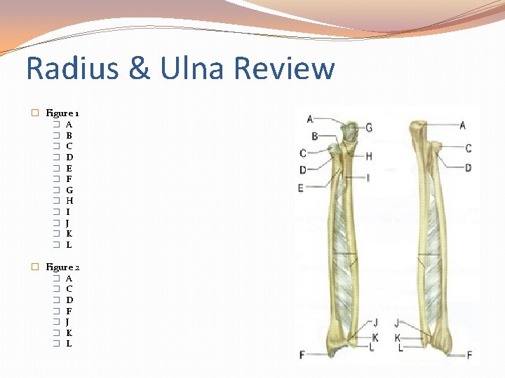 Radius & Ulna Review � Figure 1 � � � A B C D