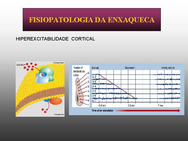 FISIOPATOLOGIA DA ENXAQUECA HIPEREXCITABILIDADE CORTICAL 