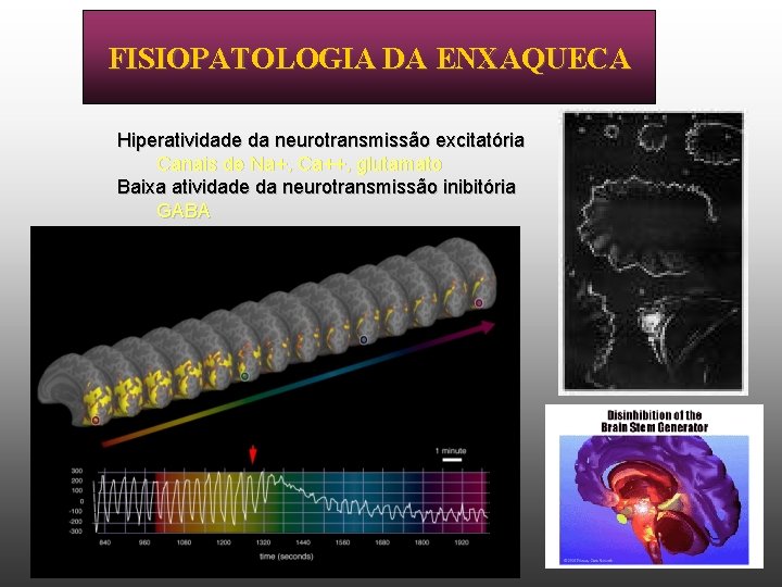 FISIOPATOLOGIA DA ENXAQUECA Hiperatividade da neurotransmissão excitatória Canais de Na+, Ca++, glutamato Baixa atividade