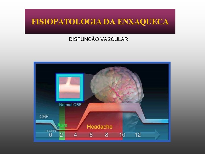 FISIOPATOLOGIA DA ENXAQUECA DISFUNÇÃO VASCULAR 