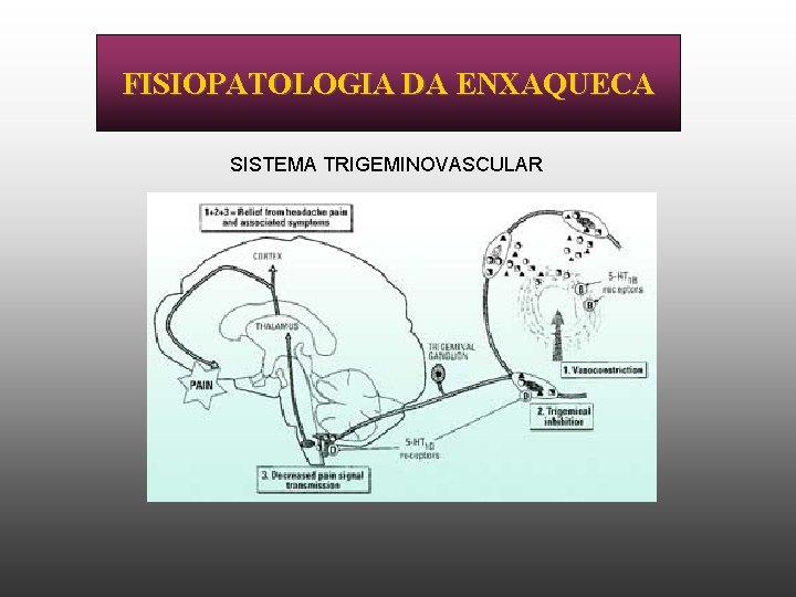 FISIOPATOLOGIA DA ENXAQUECA SISTEMA TRIGEMINOVASCULAR 