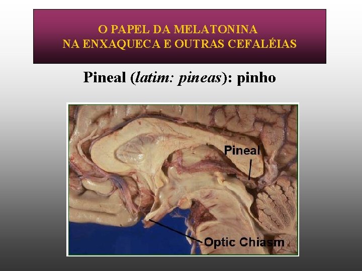 O PAPEL DA MELATONINA NA ENXAQUECA E OUTRAS CEFALÉIAS Pineal (latim: pineas): pinho 