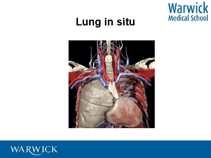 Lung in situ 