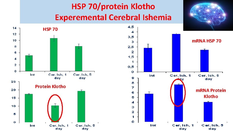 HSP 70/protein Klotho Experemental Cerebral Ishemia HSP 70 m. RNA HSP 70 Protein Klotho