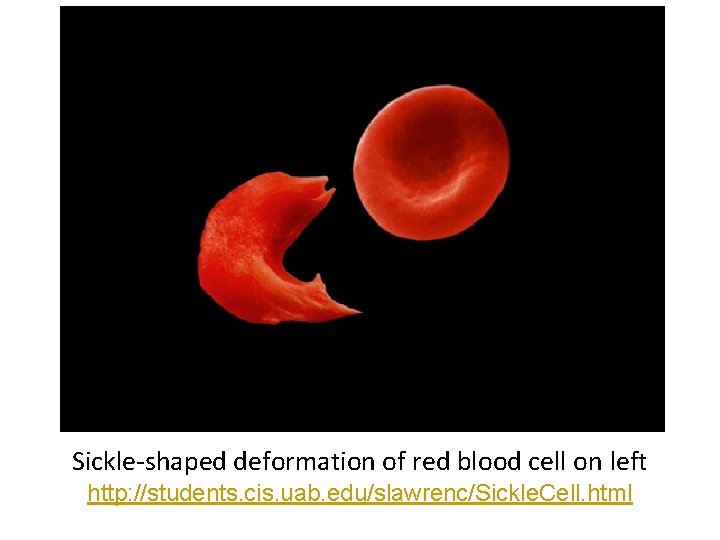 Sickle-shaped deformation of red blood cell on left http: //students. cis. uab. edu/slawrenc/Sickle. Cell.